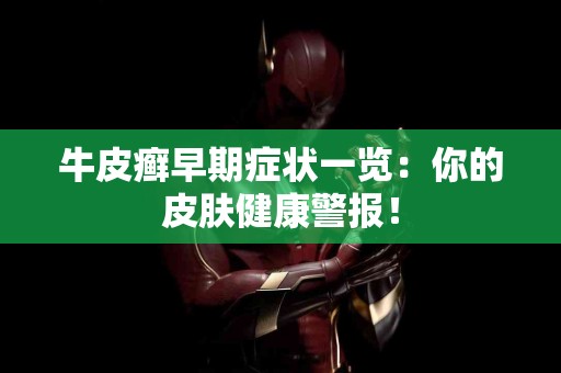牛皮癣早期症状一览：你的皮肤健康警报！