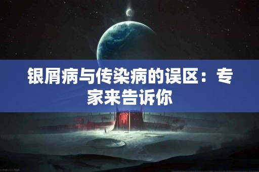 银屑病与传染病的误区：专家来告诉你