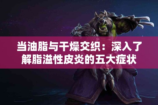 当油脂与干燥交织：深入了解脂溢性皮炎的五大症状